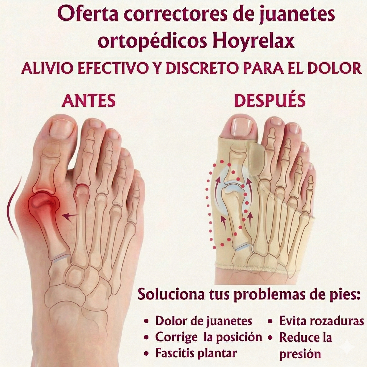 Hallux | ¡Adiós al Juanete que Duele!